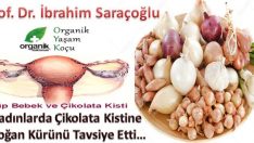 İbrahim Saraçoğlu Çikolata Kisti Tedavisi