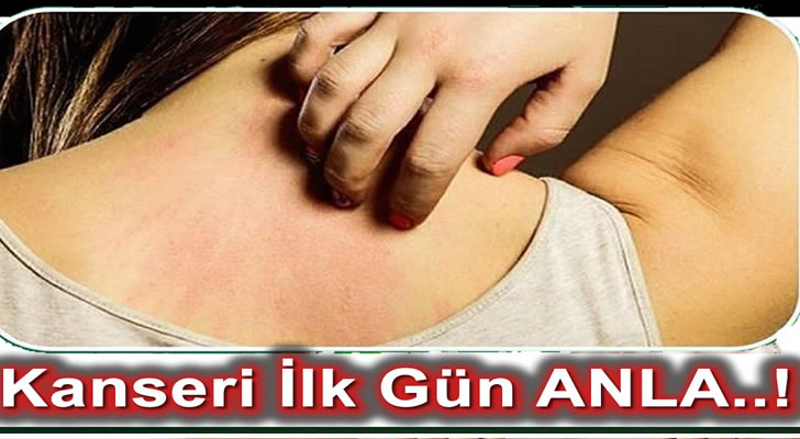 Kanser Olup olmadığınızın Belirtileri